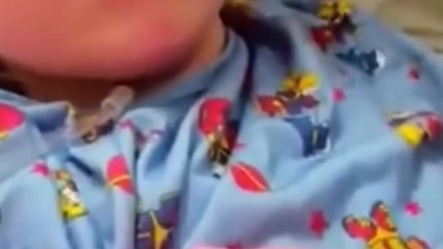 This Little baby is fighting between life and death