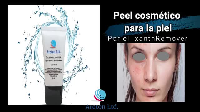 El Peeling cXanthremover Con Ácido Glicólio al 70% para diferentes problemas de la piel