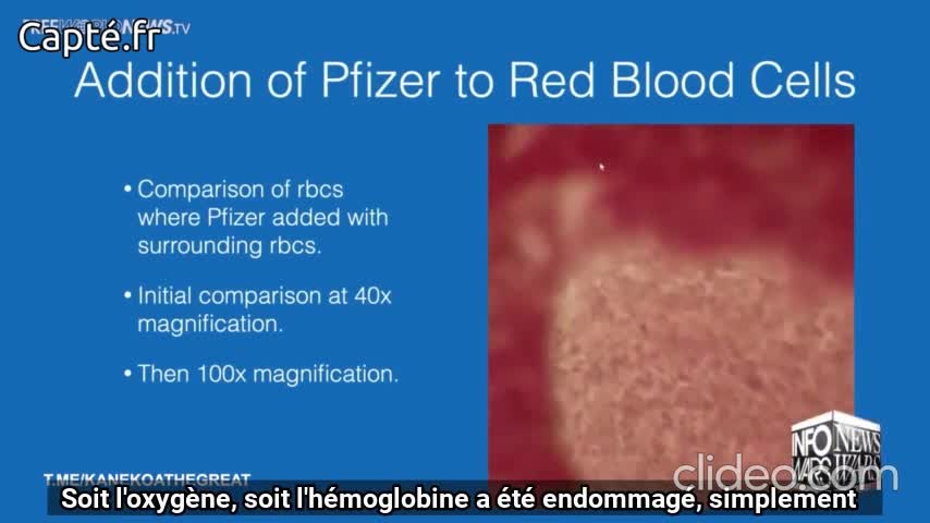 VOSTFR- Analyse sous microscope de sang avec vaccin Pfizer-BioNTech par le Dr Richard Fleming