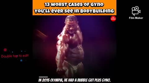 الاصبات التي تعرض لها بعض لعبي كمال الاجسام خيلال ممارستهم رفع الاثقال