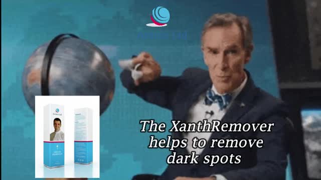 The Xanthremover Peel With 70% Glycolic Acid Best For Dark Spots