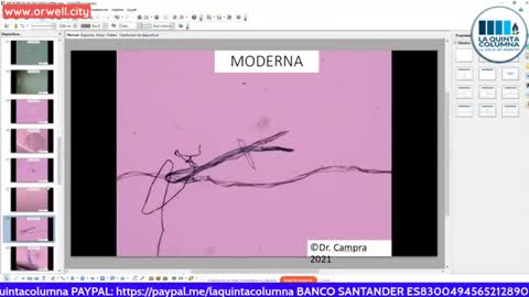LA QUINTA COLUMNA - OBSERVATIONS OF POSSIBLE MICROBIOTA IN COVID MRNA VACCINES