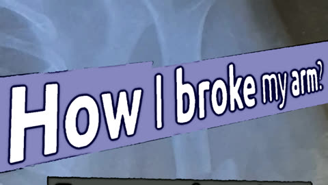 How I broke my arm! (from March 10, 2023)