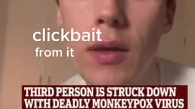 Should you be worried about monkeypox???? Hell no
