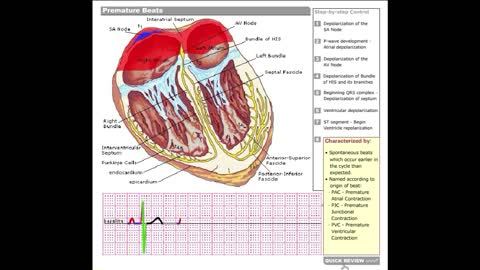 Dr Stanley's ECGcourse.com | Premature Beats Tutorial