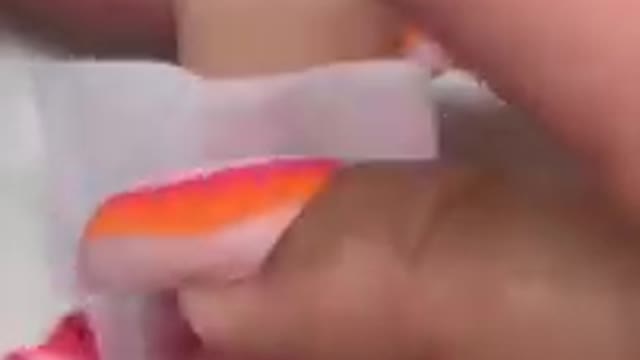 MY CLIENT GOT SOMETHING STUCK IN HER FINGE