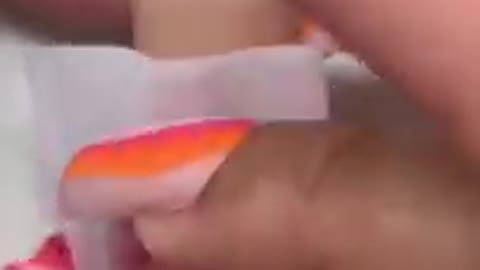 MY CLIENT GOT SOMETHING STUCK IN HER FINGE