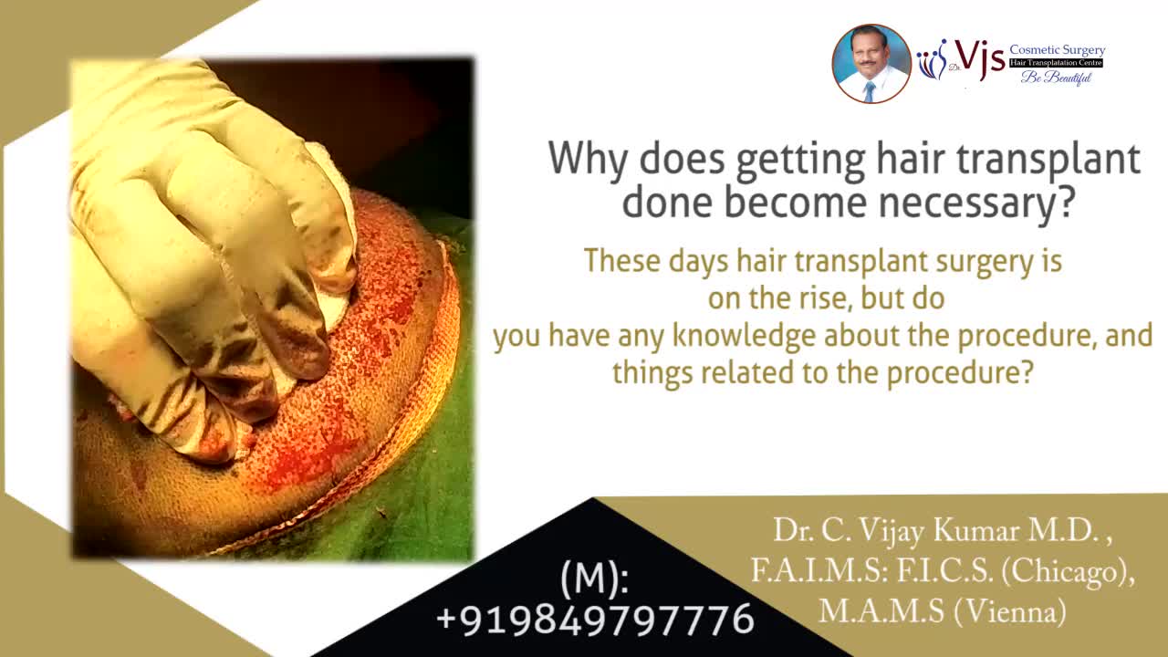 Hair Transplant Surgery in Vizag