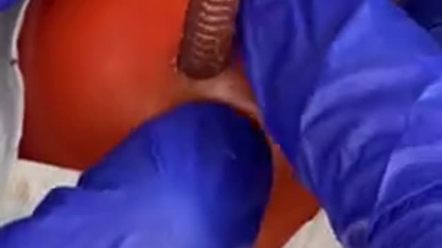 When he pulls it out...
