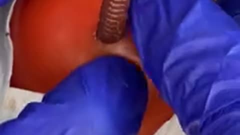 When he pulls it out...