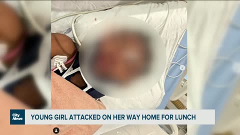 Montreal girl beaten by man on way home from school