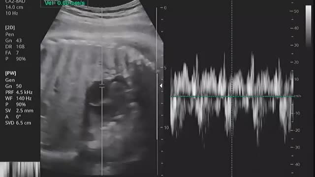 Baby ultrasound image and sound (8)