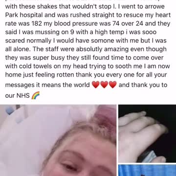 CoVid19 Vaccine Seizures in Young Woman