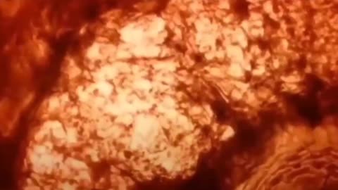 1431. CERN💥 What is CERN.