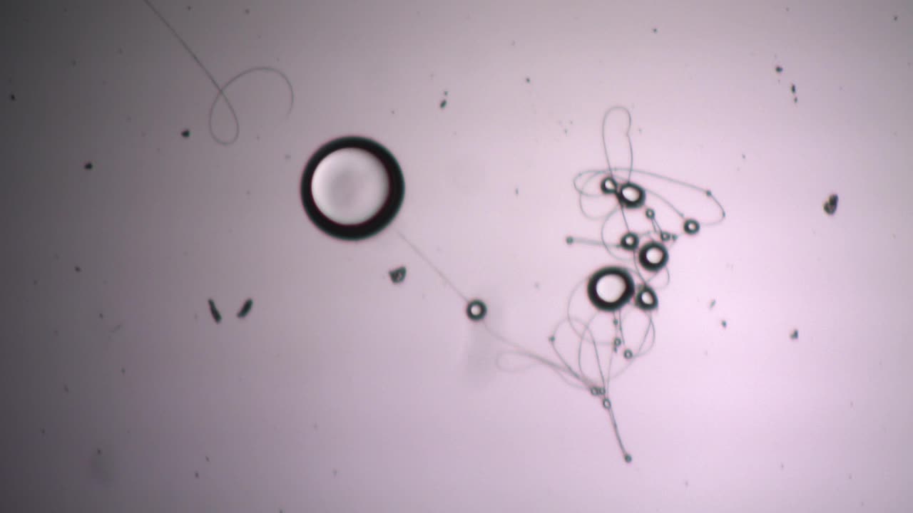 Graphene Quantum Dots Forming Graphene Thread Antennae Found Live in Human Blood