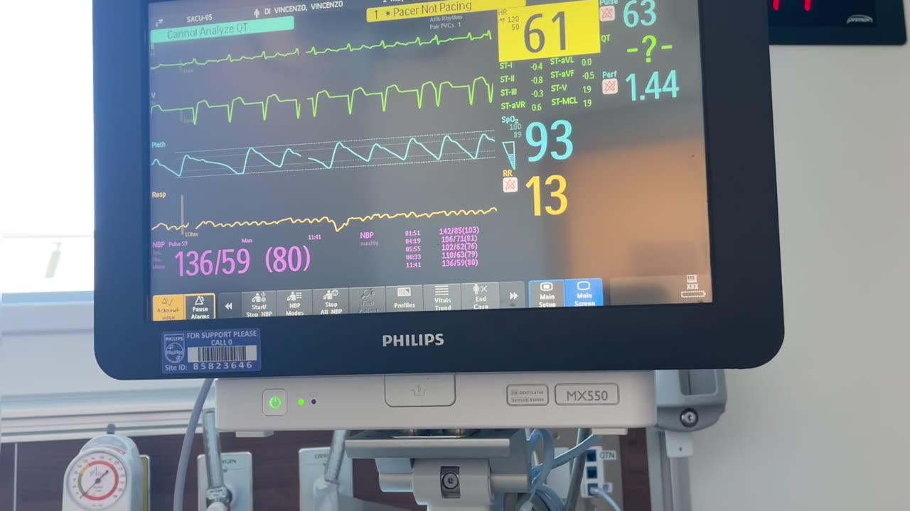 Heart ❤️ beating outside the monitor 💻