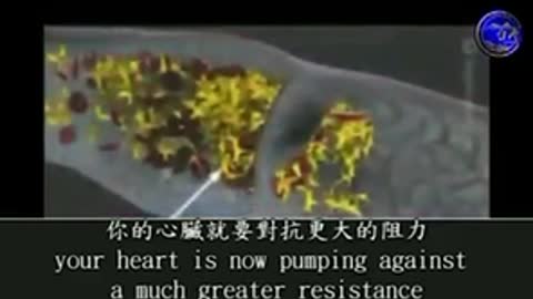 疫苗可能產生血栓