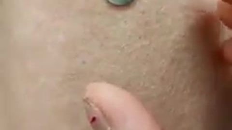 INCREDIBILE! Subito dopo il vaccino la calamita si attacca sul braccio