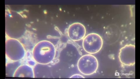 ワクチン接種後の血液中でうごめく物体