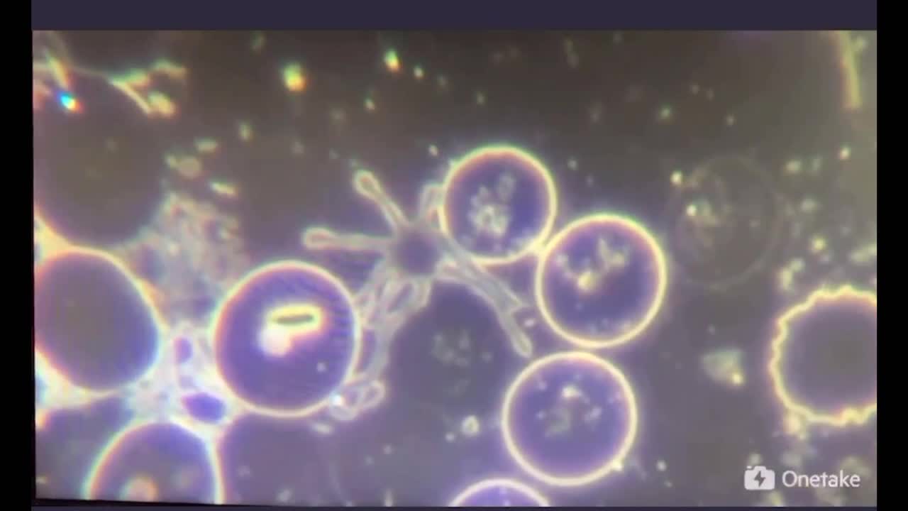 ワクチン接種後の血液中でうごめく物体