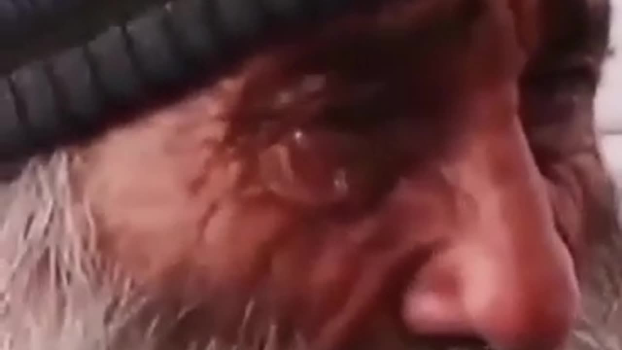 Suffering of life, pain in life