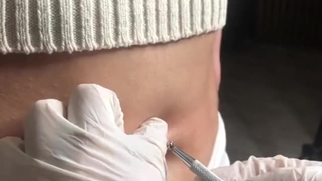It hurts????