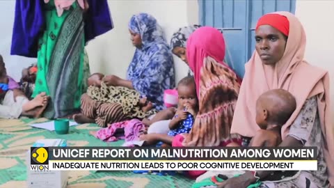 MALNUTRITION in MOTHERS surge by 25 percent in crisis-hit countries - Latest English News - WION
