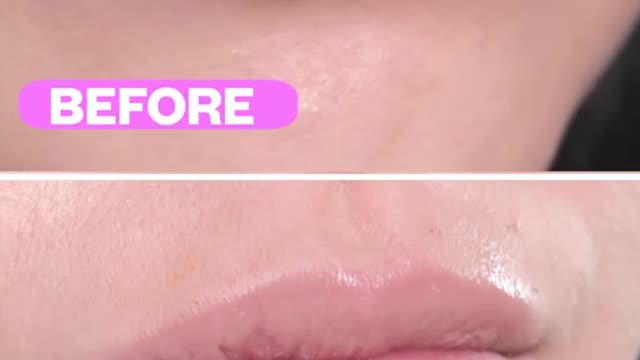 Do lips pump work Check out before and after transformation 😍 Model