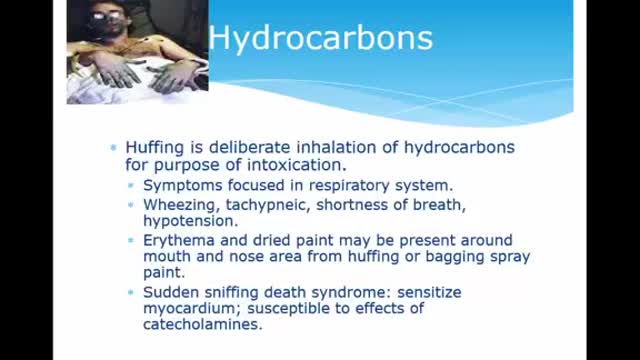 AEMT Ch 32 Toxicologic Emergencies