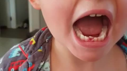 Here's How Teeth SHOULD Be Pulled Out!