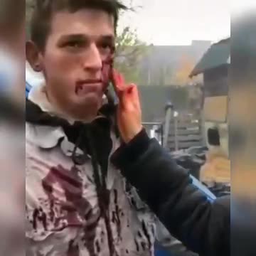 CNN in the ukraine 💣