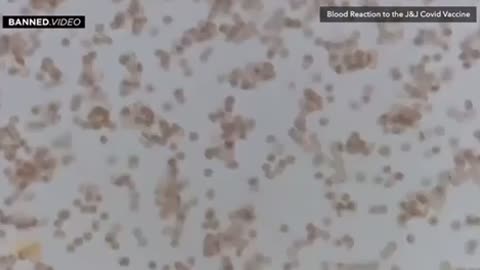 What Covid Vaxx does to live Blood