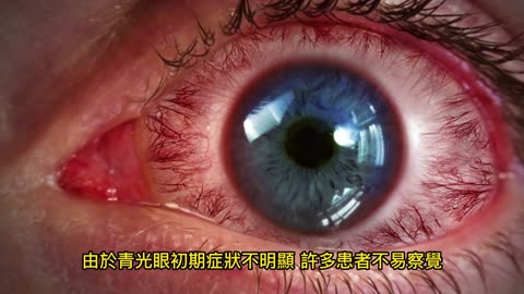 「視力小偷」 青光眼患者將破億