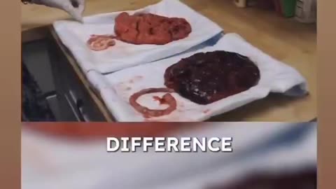 Plant-based vs Animal-based Placenta