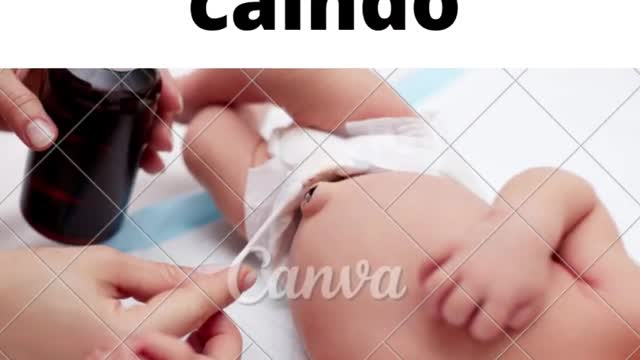 Como saber se o umbigo do bebê está caindo?#shorts #shortsvideo #shortsbeta #shortsyoutube