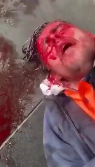 Melbourne Police crack anti-mandatory vaccine protesters skull open.