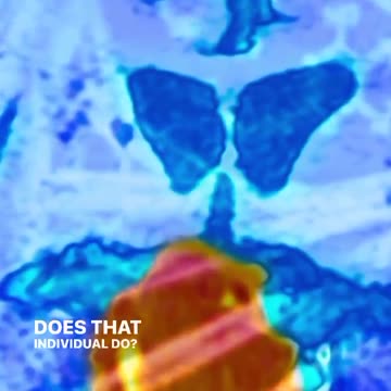 🤔 Spontaneous Remission