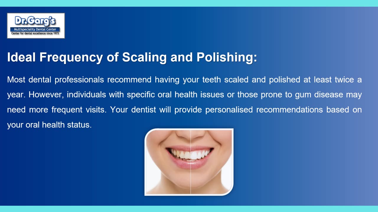 Teeth Scaling and Polishing Explained: A Key to Optimal Oral Health