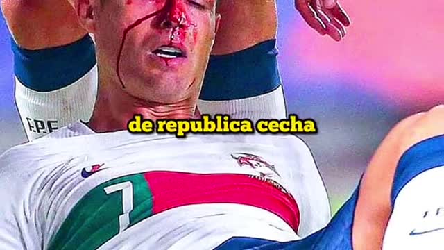 Cristiano Injury