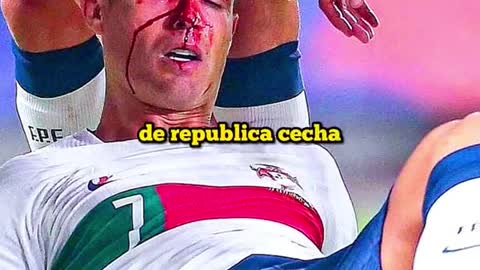 Cristiano Injury
