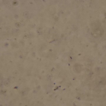 Pfizer vaccine microscopic findings