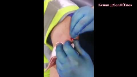 Solid proof that at least some of the vaxxed were injected with what is likely an RFID chip- 7-26-21