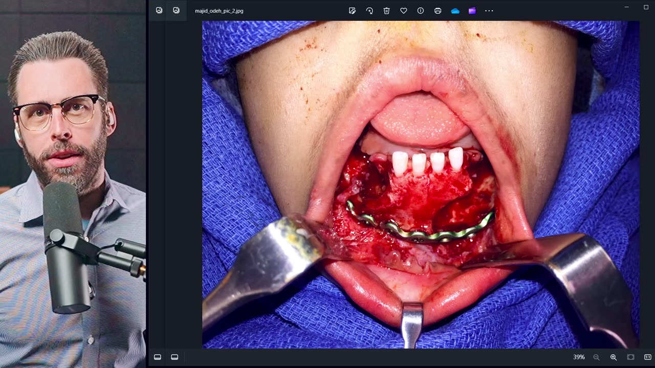 2 YEAR OLD BOY LOSES JAW FROM INFECTED WATER AT DENTAL CLINIC RUN BY LAWYER - JURY TRIAL OCT 7 2024