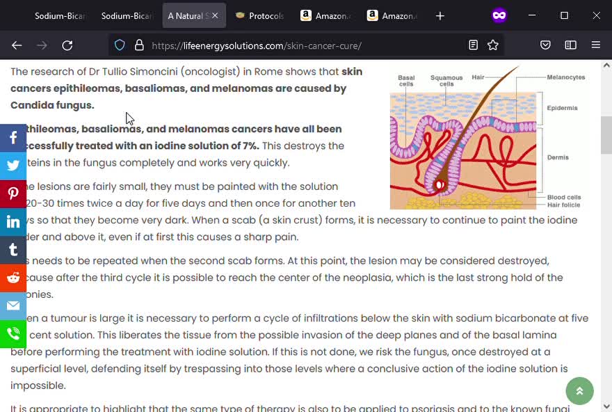 Treating Skin Cancer with Iodine