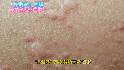 「長新冠」困擾 歸納常見7症狀