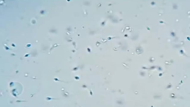 little tadpoles magnified 100 times under the microscope