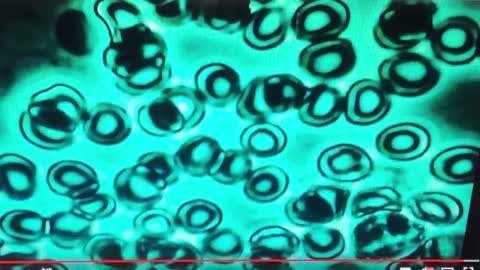 #88 Structured water vs Hydrogen water blood sample