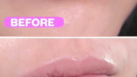 Do lips pump work Check out before and after transformation 😍 Model