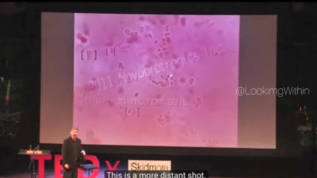 Cancer killed with music 🎼🎼 Specific formulations of music frequencies heal🎵🎶