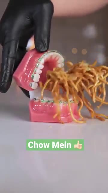 Panda Express Food Choices Vs Braces